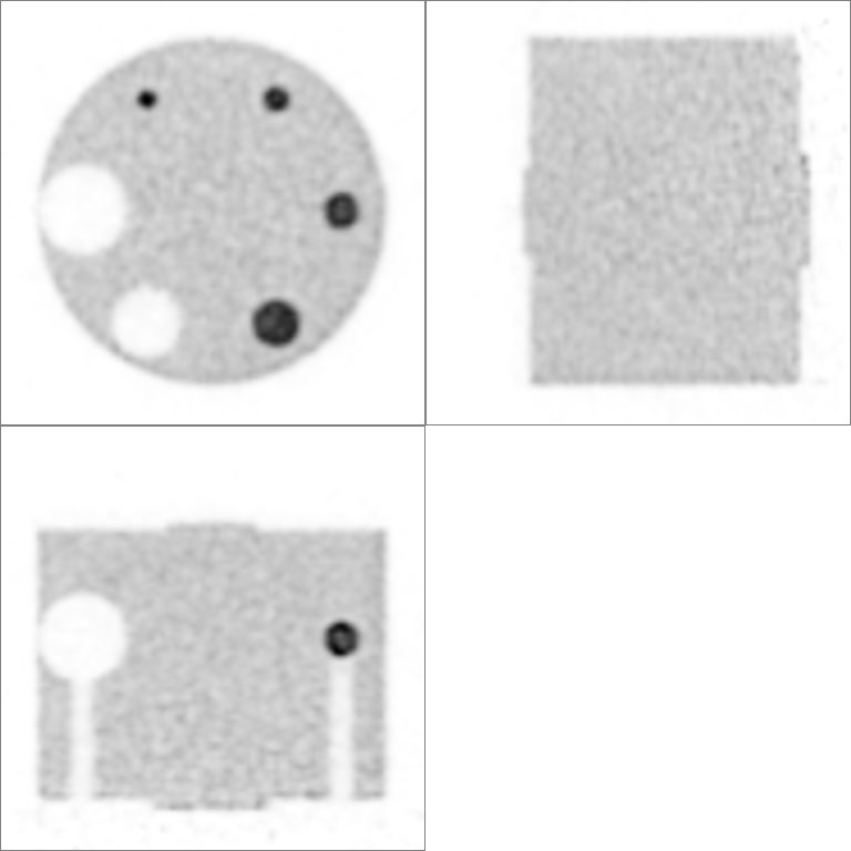 Brain IQ phantom PET scan image by Vrain<br>